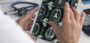 Doctor viewing brain scans on a digital tablet